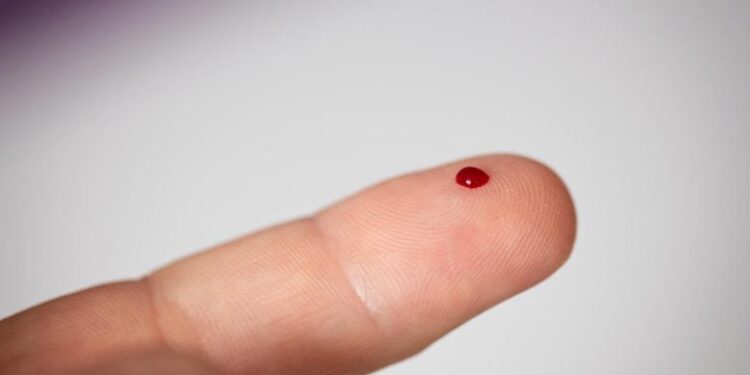 This New Blood Test Can Detect Cancer Before Tumors Appear