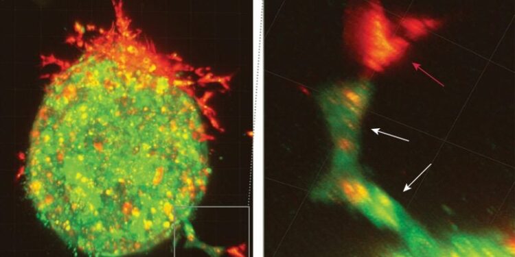 This Is How Ovarian Cancer Spreads Before Doctors Can Detect It