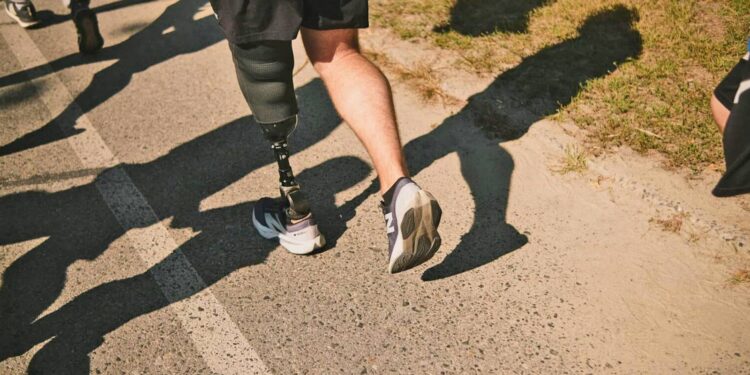 How body image changes when using a robot prosthetic