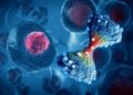 New AI Model Predicts Cancer Spread With Incredible Accuracy