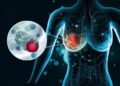 Scientists Discover Molecular “Switch” That Could Stop Breast Cancer From Spreading