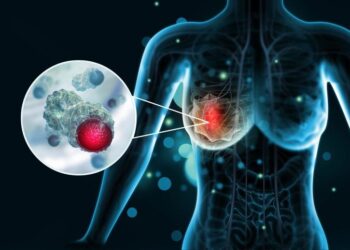 Scientists Discover Molecular “Switch” That Could Stop Breast Cancer From Spreading