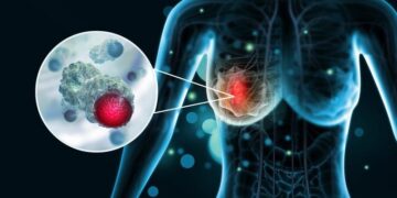 Scientists Discover Molecular “Switch” That Could Stop Breast Cancer From Spreading