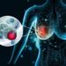 Scientists Discover Molecular “Switch” That Could Stop Breast Cancer From Spreading