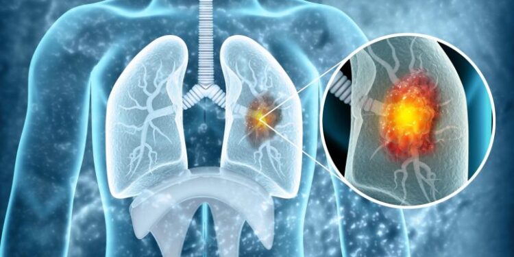 Scientists Uncover Aging Link That Could Change How Cancer Is Treated