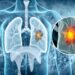 Scientists Uncover Aging Link That Could Change How Cancer Is Treated
