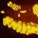 Scientists Discover Game-Changing New Way To Treat High Cholesterol