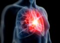 Hidden Heart Risk Found in 1 in 5 People, Study Warns