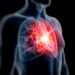 Hidden Heart Risk Found in 1 in 5 People, Study Warns