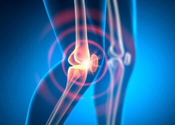 Scientists Uncover New Cause of Persistent Rheumatoid Arthritis
