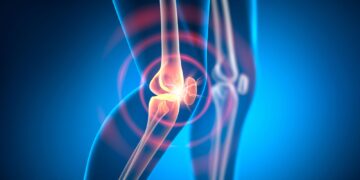 Scientists Uncover New Cause of Persistent Rheumatoid Arthritis
