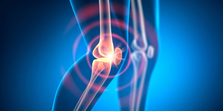 Scientists Uncover New Cause of Persistent Rheumatoid Arthritis