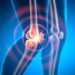 Scientists Uncover New Cause of Persistent Rheumatoid Arthritis