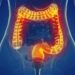 Scientists Flip Immune System “Switch,” Uncover Surprising Path To Stop Gut Inflammation