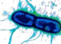 Scientists Discover the “Achilles’ Heel” of Two of the World’s Deadliest Diarrhea Bacteria
