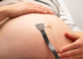 Breakthrough Ultrasound Patch Tracks Blood Flow and Fetal Health in Real Time