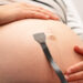 Breakthrough Ultrasound Patch Tracks Blood Flow and Fetal Health in Real Time