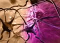 New Strategy Shows Promise Against the Deadliest Brain Cancer