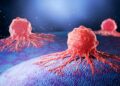 New Strategy Could Break Pancreatic Cancer’s Protective Shield