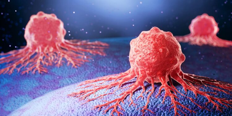 New Strategy Could Break Pancreatic Cancer’s Protective Shield