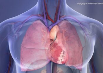 Common Mouth Bacteria May Trigger Dangerous Calcium Buildup in the Heart