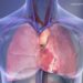 Common Mouth Bacteria May Trigger Dangerous Calcium Buildup in the Heart