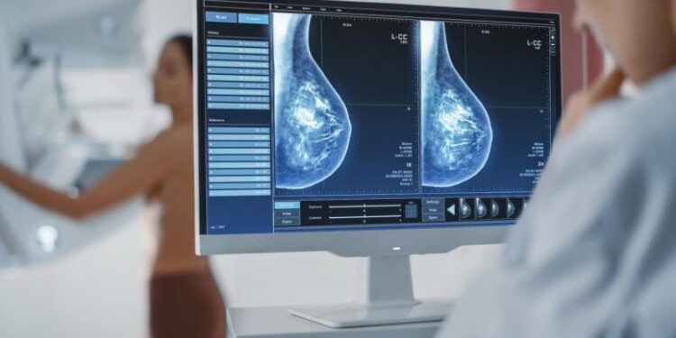 Scientists Reassess a Major Risk of Breast Cancer Screening