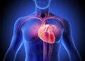 A Hidden Form of Heart Failure Is Leaving Millions Breathless
