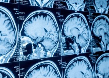 Scientists Find Signs of Brain Aging Decades Before Cognitive Symptoms