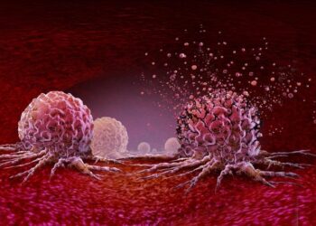 Noninvasive Cancer Treatment Looks Safe, yet 11% of Patients Died Within a Month