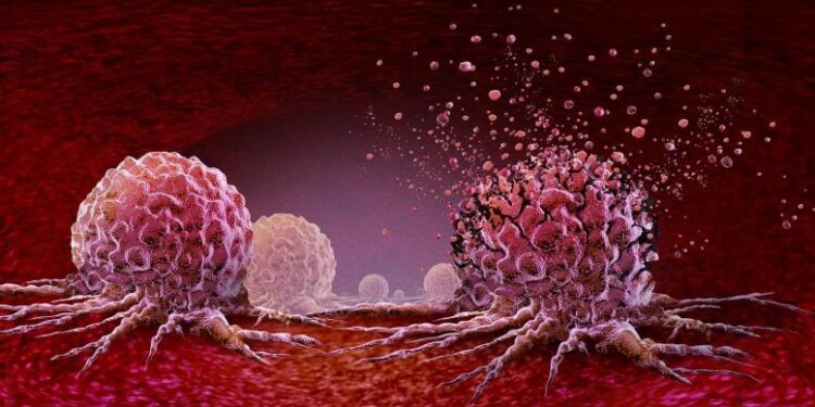 Noninvasive Cancer Treatment Looks Safe, yet 11% of Patients Died Within a Month